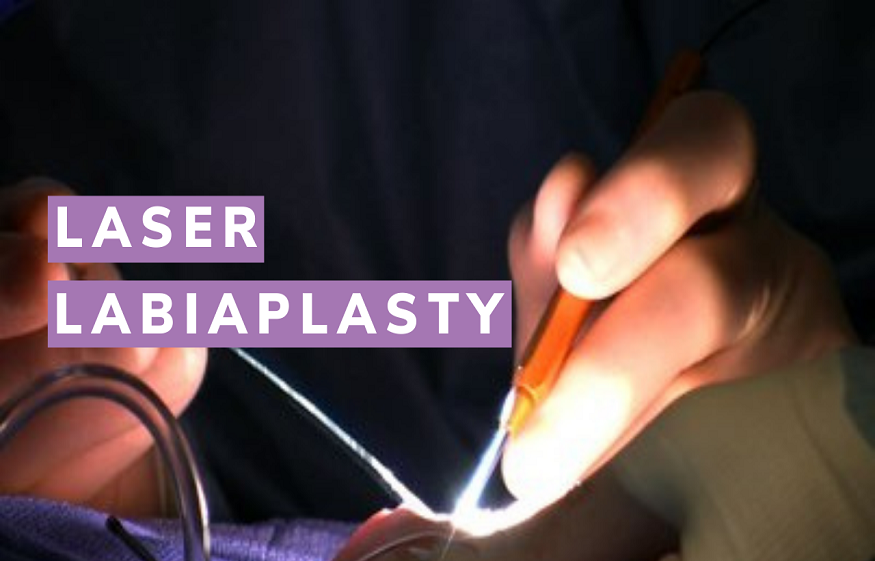 Labiaplasty