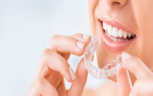 Treatment Plans in Invisalign