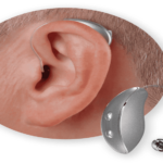 Canal Hearing Aid